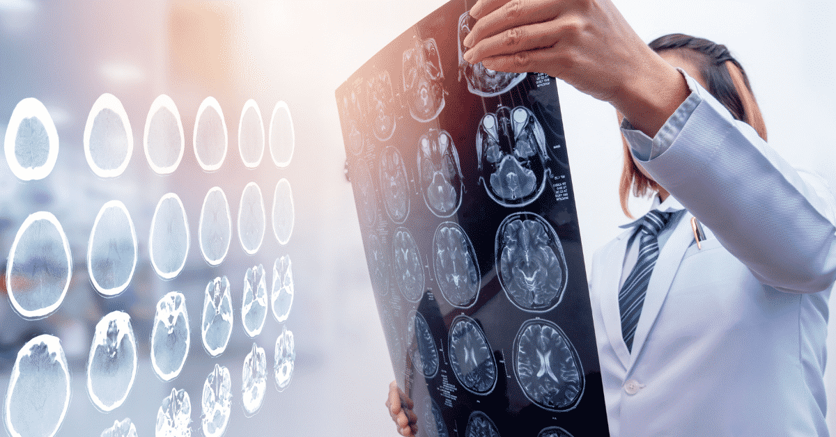 Doctor checking brain injury results